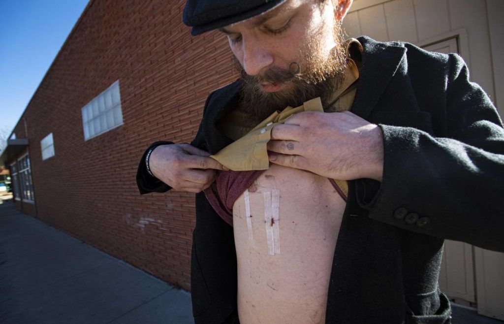 Trail stabbing suspect told victims he was Jesus, rubbed spit in shape of cross on their foreheads
